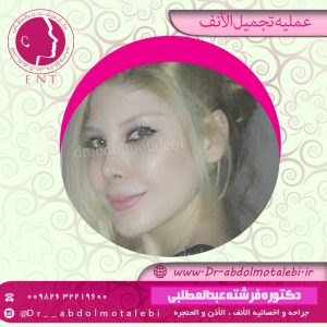 تدليك الأنف بعد الجراحة