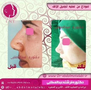 كيفية العثور على أفضل اخصائیة الأنف في محافظة کرج؟