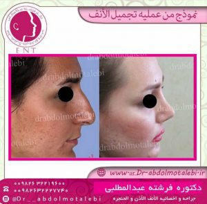 كيفية العثور على أفضل اخصائیة الأنف في محافظة کرج؟
